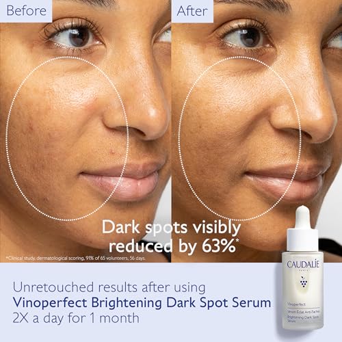 serum vinoperfect 30ml 